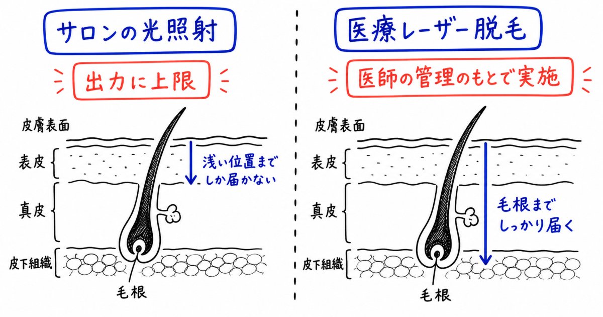 濃くなった体毛への対処法と医療機関での毛のケア