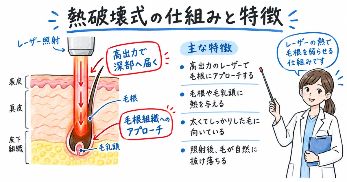 医療脱毛の熱破壊式とは？仕組みと特徴を医師がわかりやすく解説