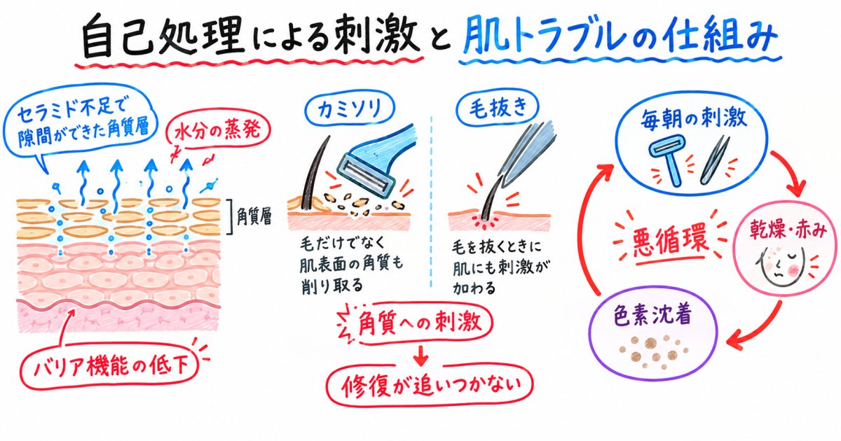毎日のカミソリがアトピー肌を悪化させる仕組み