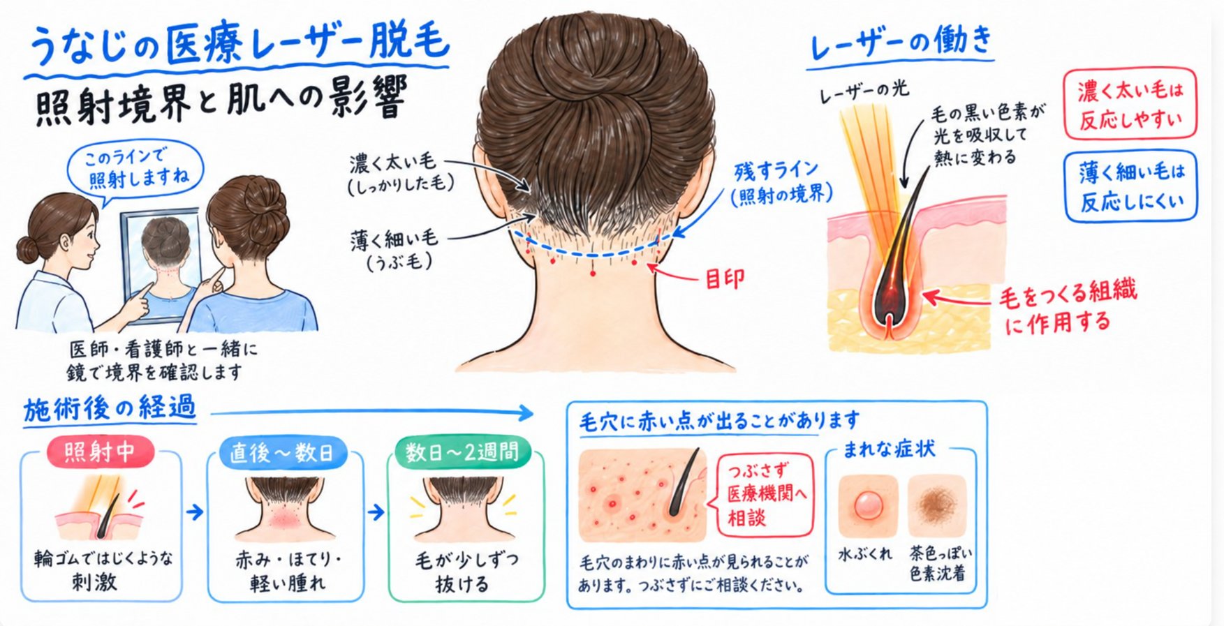 照射する境界と肌への影響を施術前に確かめる