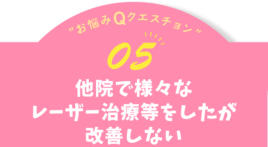 お悩みQクエスチョン05 他院で様々なレーザー治療等をしたが改善しない