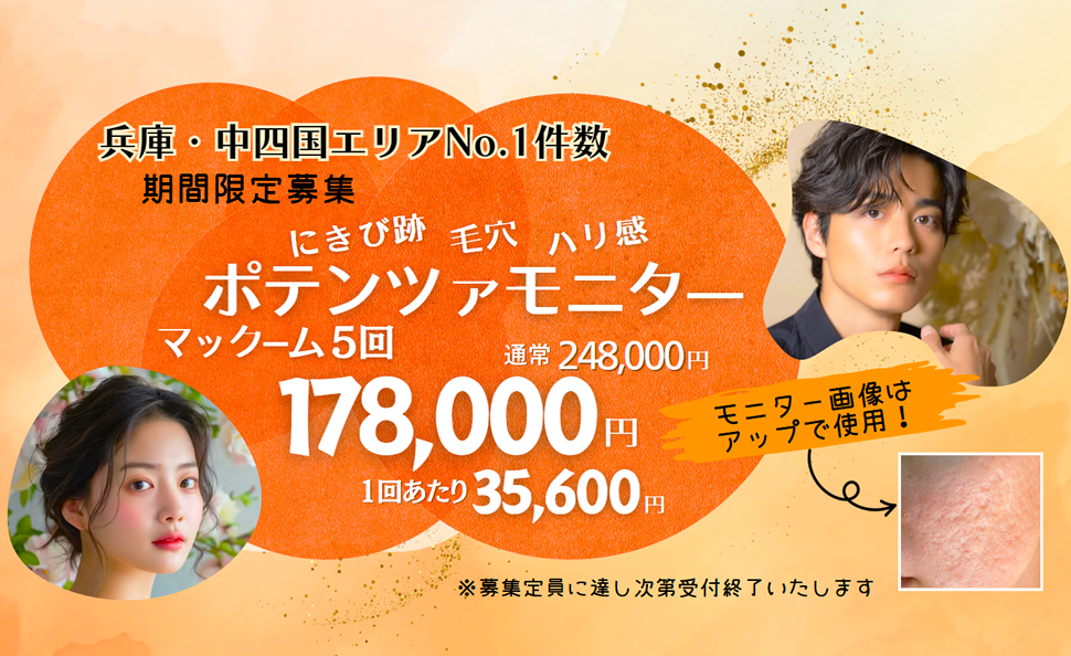 ポテンツァモニター募集