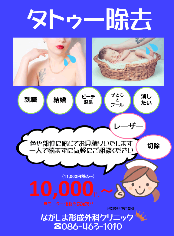 タトゥ除去料金