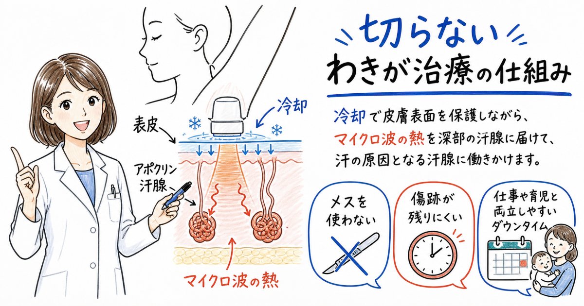 仕事や学校で休めない方へ！切らないわきが治療の仕組みを解説