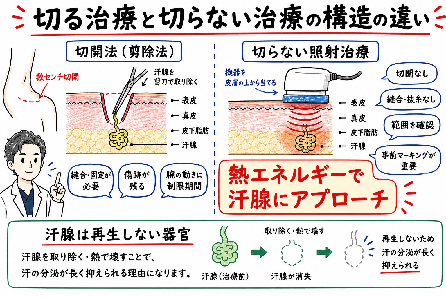 外科手術（切開法）と切らない照射治療の構造的な違いと選択基準